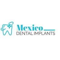 mexicodentalimplants